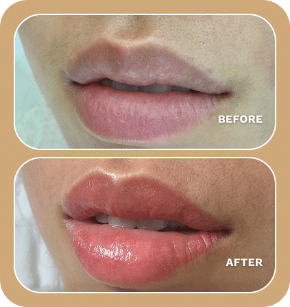Close-up of lips showing a "before" image with natural, matte lips and an "after" image enhanced by Lip Blushing for a glossy, fuller, and more defined look.