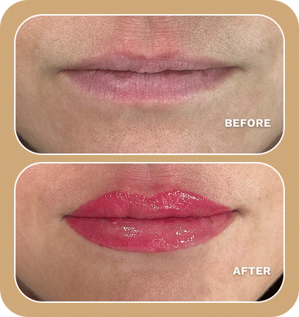 Close-up comparison of lips, showing pale, uncolored lips labeled "Before" and glossy, red-tinted lips labeled "After," highlighting the stunning results of Lip Blushing.
