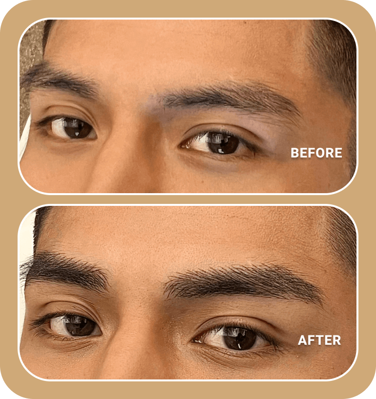 Close-up comparison of a person's eyebrows before and after microblading; the "after" image shows fuller, more defined eyebrows thanks to the precision of nanobrows.