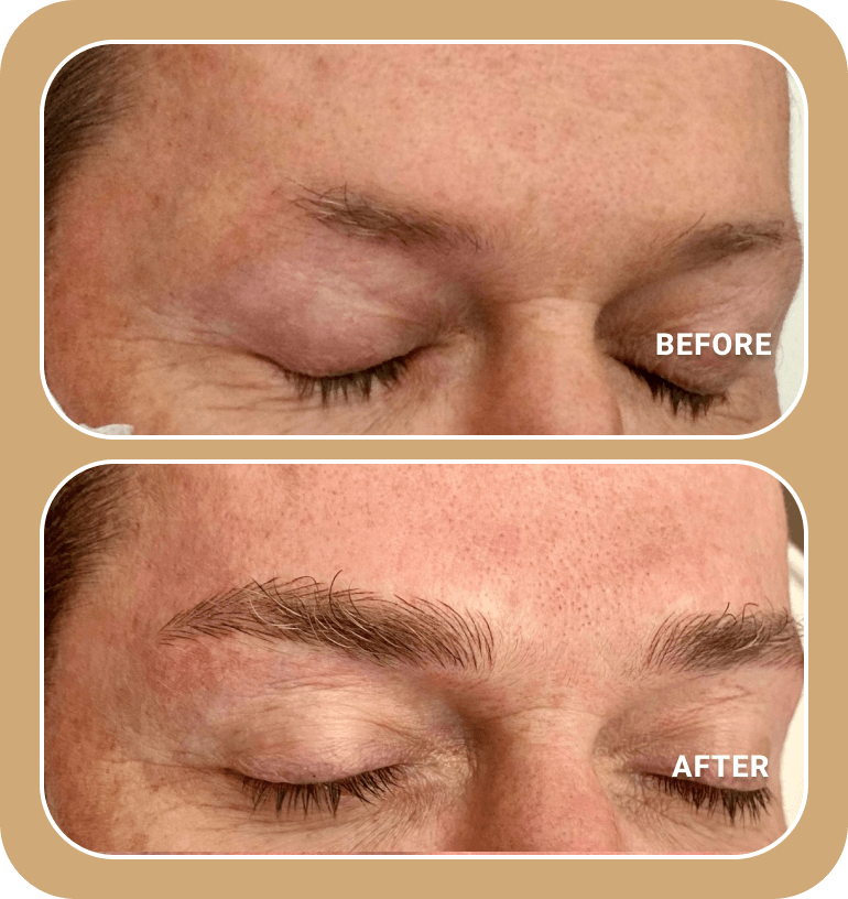 Close-up of a person's closed eyes showing sparse eyebrows in the "before" image and fuller, defined eyebrows in the "after" image.