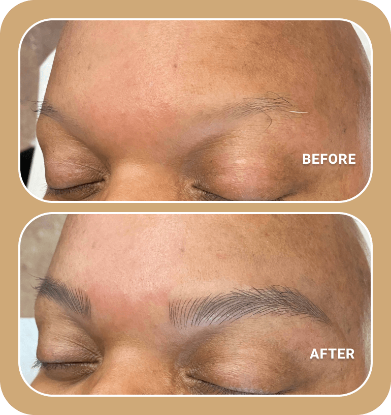 Close-up of a person's closed eyes showing sparse eyebrows in the "before" image and fuller, well-defined eyebrows in the "after" image, demonstrating an eyebrow enhancement treatment.