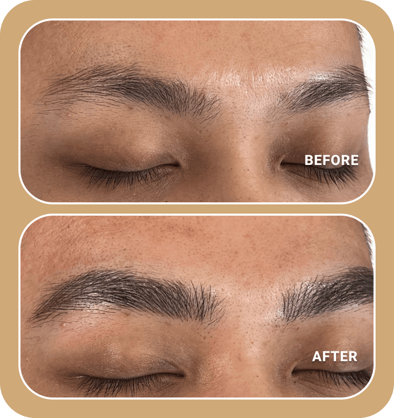Close-up of closed eyes showing eyebrows before and after treatment; top image shows sparse brows, bottom image shows fuller, more defined brows.