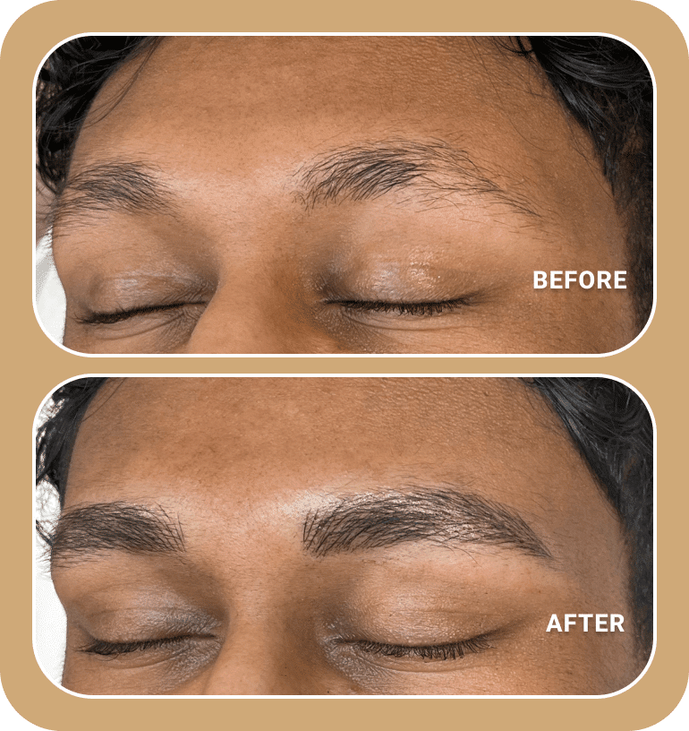 Before and after photos of a person's closed eyes showing sparse eyebrows in the top image and fuller, well-shaped eyebrows in the bottom image.