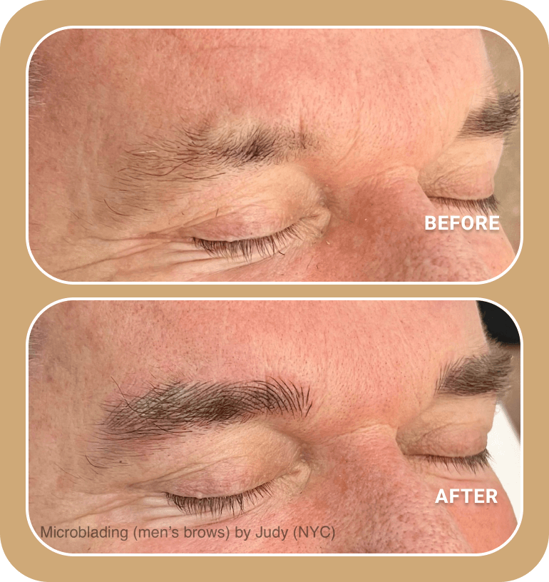 Close-up comparison of a man's eyebrows before and after microblading, showing fuller and more defined brows in the "after" image.