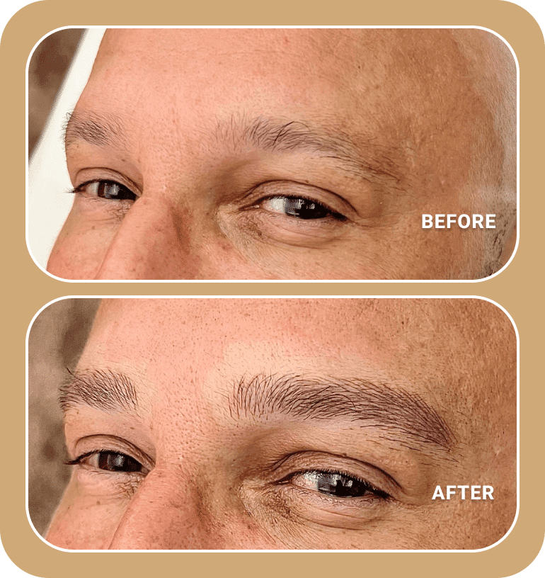 Close-up of a person's eyes and eyebrows in two panels labeled "before" with sparse brows and "after" featuring fuller, defined eyebrows achieved through Microblading or Nanobrows.