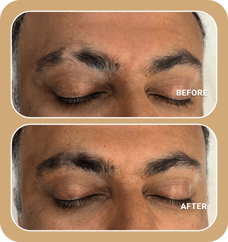 Close-up comparison of a person's closed eyes showing eyebrows before and after a cosmetic or grooming treatment. Top image labeled "BEFORE," bottom image labeled "AFTER.