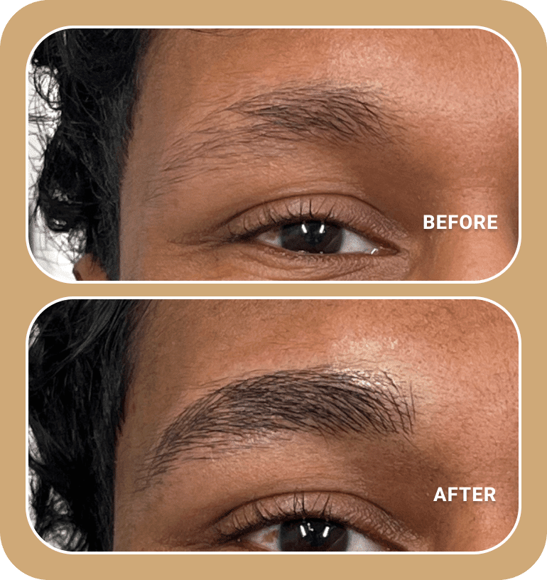 Close-up of an eye area showing sparse eyebrows in the "before" image and fuller, shaped eyebrows in the "after" image.