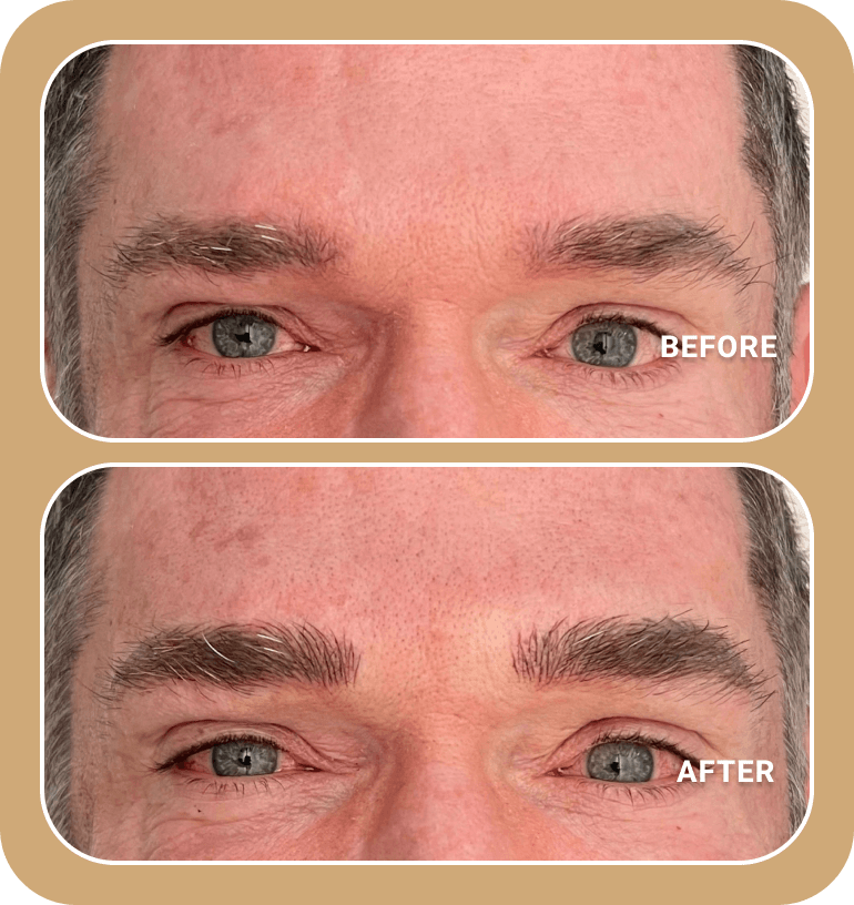 Before and after close-up photos of a man's eyes and eyebrows, showing fuller, darker eyebrows in the after image.