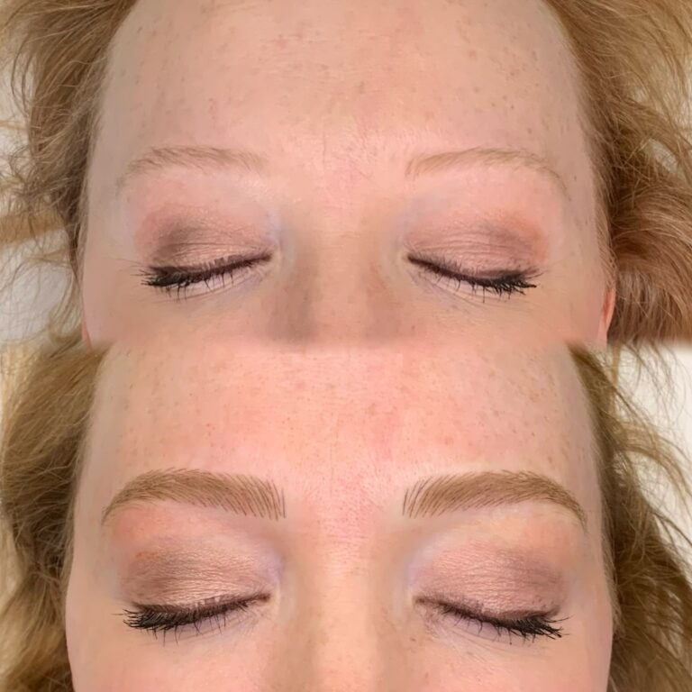 Before and after comparison of closed eyes showing sparse eyebrows in the top image and fuller, defined eyebrows in the bottom image, likely after cosmetic enhancement.