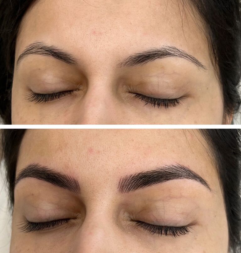 Top: Closed eyes with thin, natural eyebrows. Bottom: Closed eyes with fuller, well-defined eyebrows after a cosmetic enhancement.