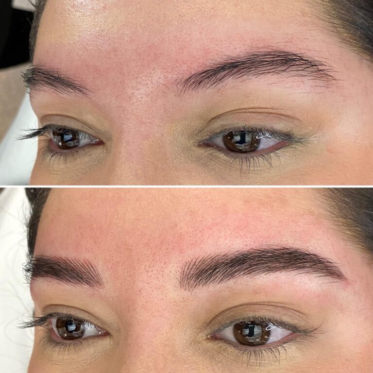 Before and after image showing a person's eyebrows; the top shows sparse eyebrows, while the bottom shows fuller, more defined eyebrows after a cosmetic procedure.