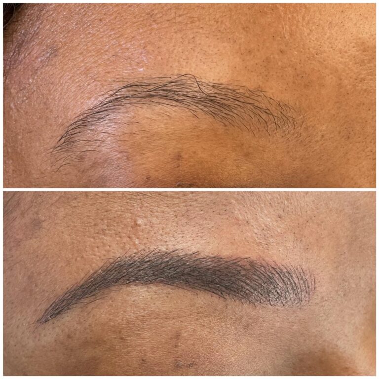 Close-up comparison of an eyebrow before (top, sparse and thin) and after (bottom, fuller and more defined) eyebrow enhancement treatment.