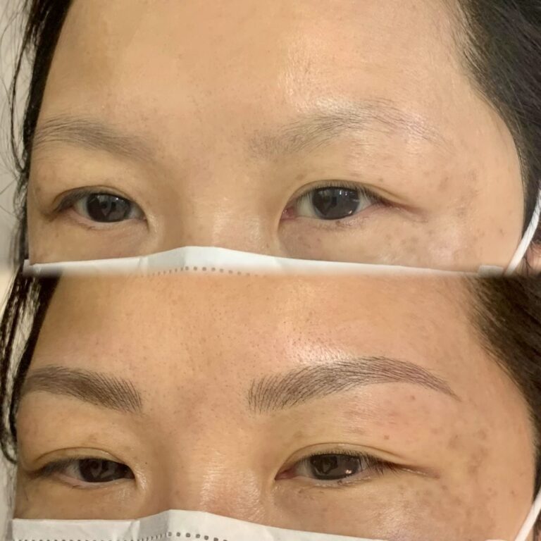 Before and after photo showing a person’s eyes and upper face with sparse eyebrows (top) and after eyebrow cosmetic enhancement (bottom). Both images show the person wearing a mask.