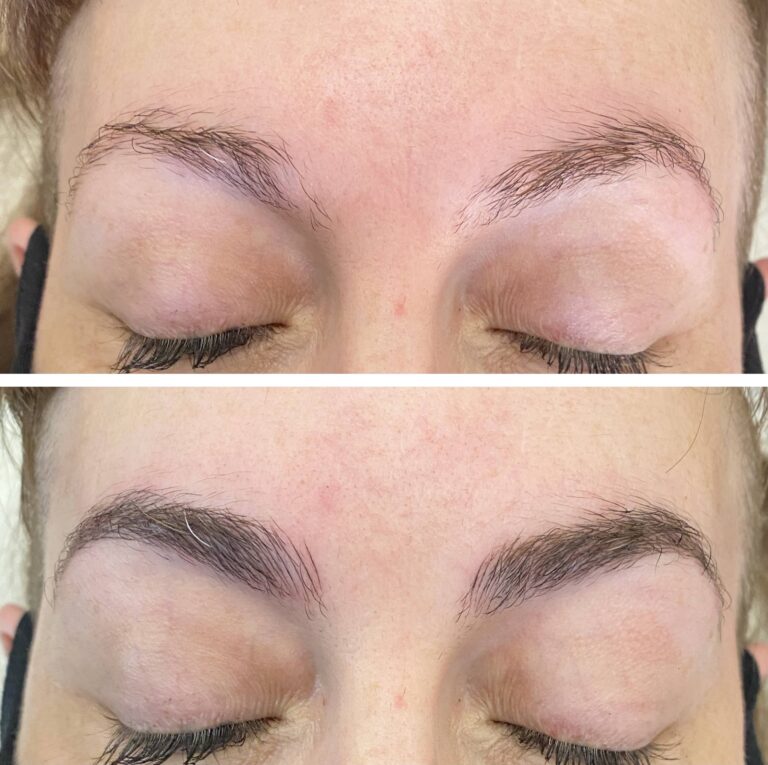 Close-up of a person's eyebrows with eyes closed; the top image shows sparse eyebrows, while the bottom image shows fuller, more defined eyebrows.