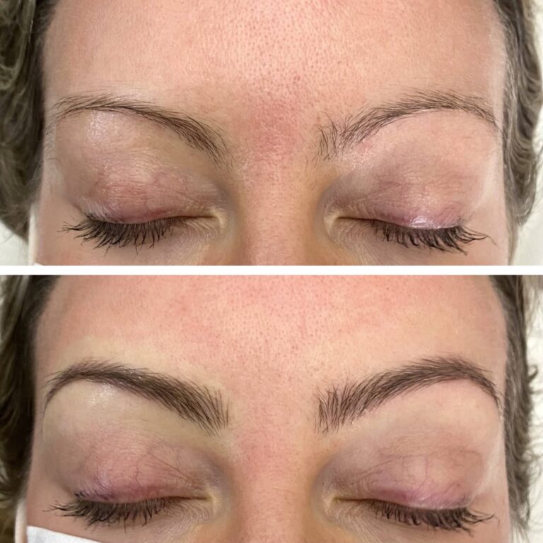 Close-up of a person's closed eyes showing eyebrows before (top) and after (bottom) an eyebrow treatment; the after image shows fuller, more defined brows.