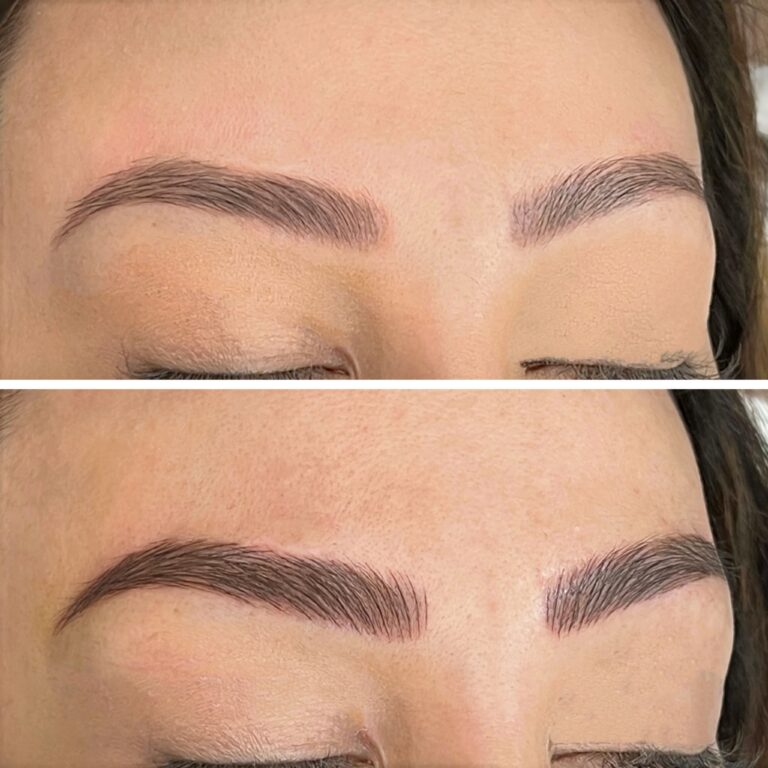 Close-up comparison of eyebrows before (top) and after (bottom) a cosmetic treatment, showing fuller and more defined brows in the after image.