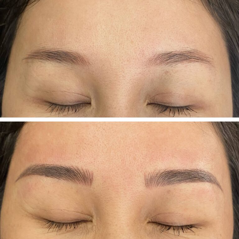 Close-up of a person's closed eyes; the top image shows sparse eyebrows, and the bottom image shows fuller, defined eyebrows after a cosmetic procedure.