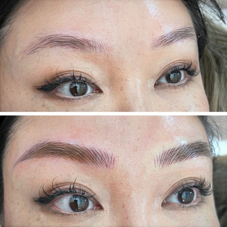 Close-up of a person's eyes showing eyebrows before (sparse, thin) and after (fuller, defined) a cosmetic eyebrow enhancement treatment.