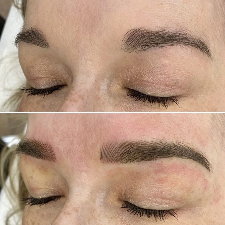 Close-up of a person's closed eyes shows eyebrows before (top) and after (bottom) a cosmetic treatment, with the latter appearing fuller and more defined.