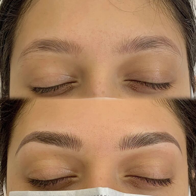 Close-up of a person's closed eyes showing eyebrows before (top, sparse) and after (bottom, fuller and more defined) a cosmetic eyebrow treatment.