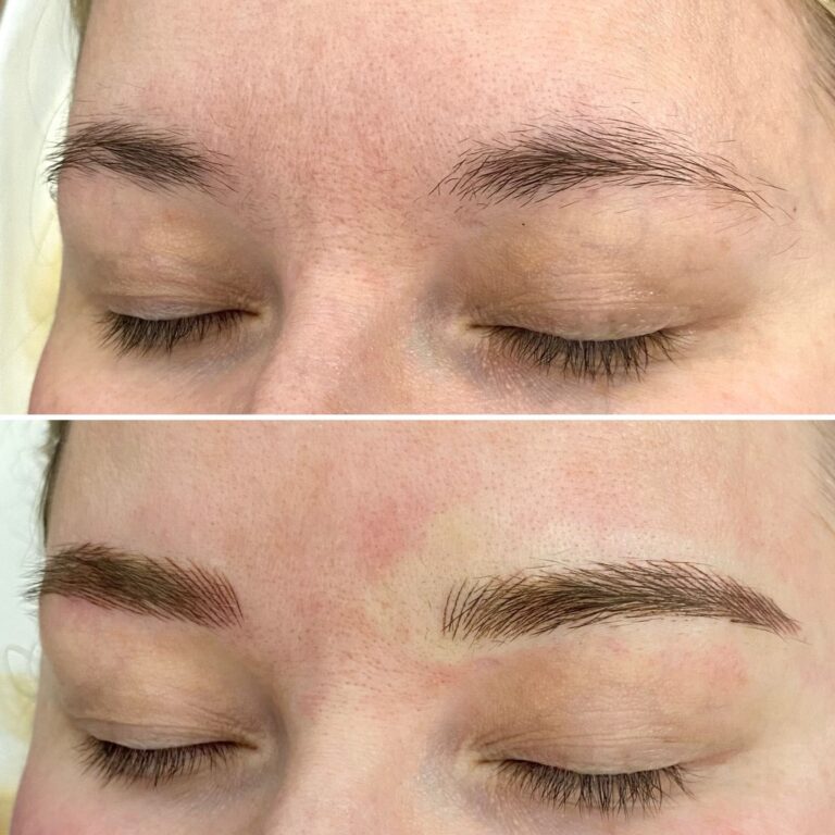 Close-up of a person's eyebrows and closed eyes; the top shows sparse, natural brows, while the bottom shows fuller, well-defined eyebrows after enhancement.