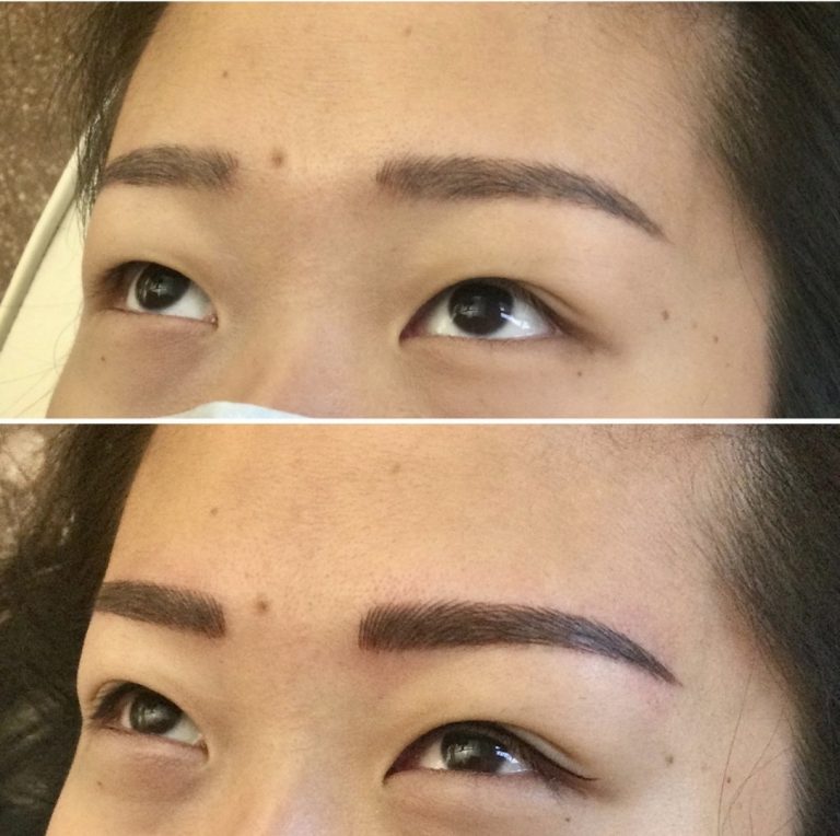 A before-and-after comparison of a woman's eyebrows, showing natural brows in the top image and fuller, more defined brows in the bottom image after a cosmetic procedure.