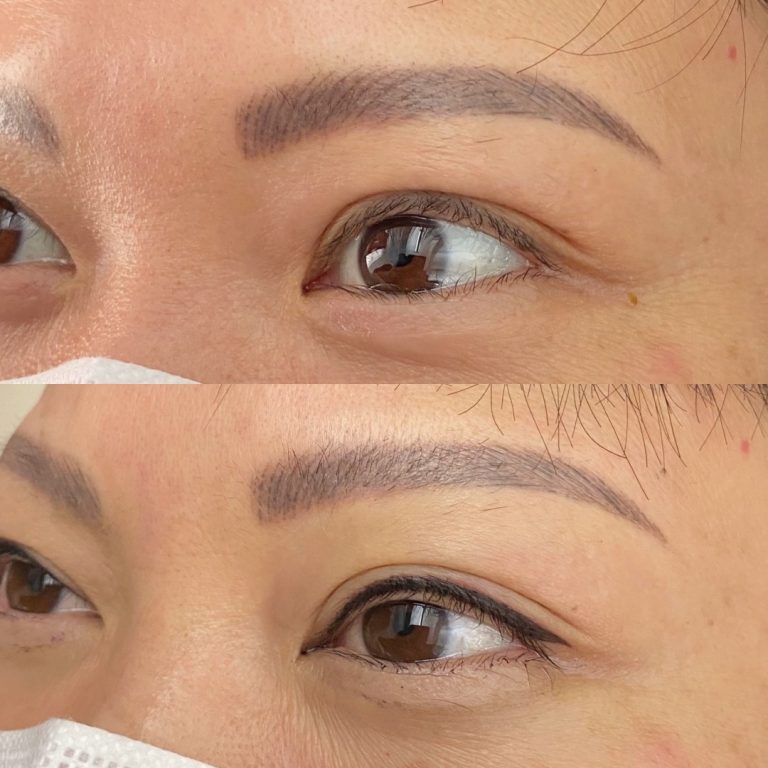 Close-up of a person's eyes showing eyebrows before (top) and after (bottom) a cosmetic procedure, such as microblading or eyebrow tattooing.