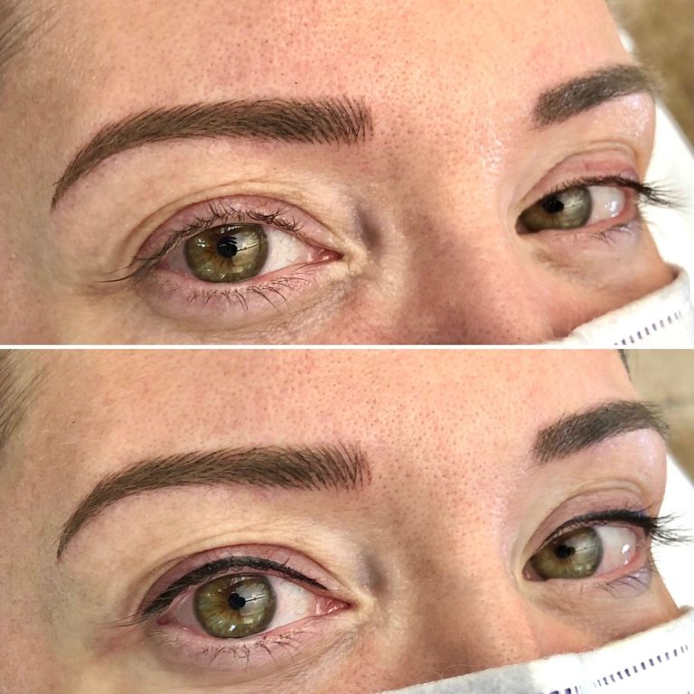 Close-up of a person's eyes showing before (top) and after (bottom) eyebrow microblading, with fuller, more defined brows in the after image.