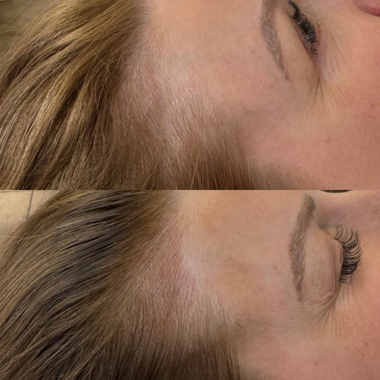 Side-by-side comparison of a person's eyebrow area before and after cosmetic enhancement, showing fuller and more defined eyebrows in the after image.