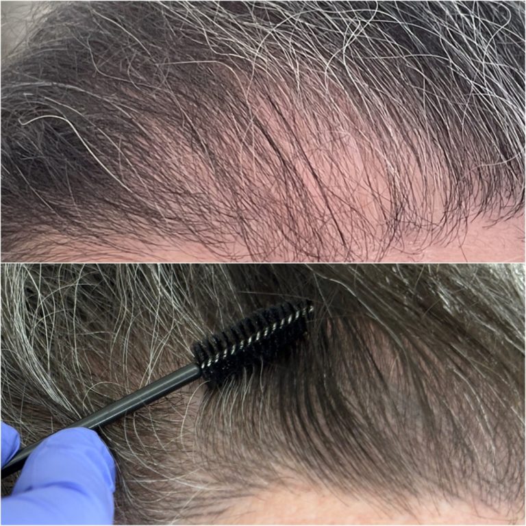 Two close-up images of a person's hairline with visible gray hairs; the bottom image shows a gloved hand applying dye with a spoolie brush.