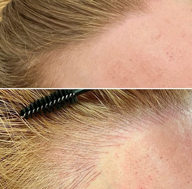 Close-up comparison of a person's hairline before and after makeup application, showing fuller, more defined edges in the after image.