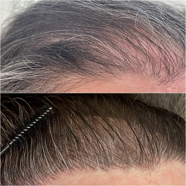 Two close-up images showing the top of a person's head before and after hairline touch-up; the bottom image includes a brush applying product to the hairline.