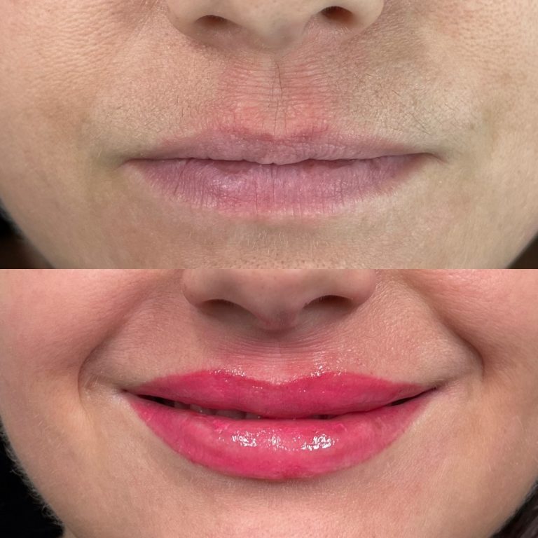 Split image showing a person’s lips before and after makeup application; the upper image has natural lips, the lower image shows lips with glossy pink lipstick.