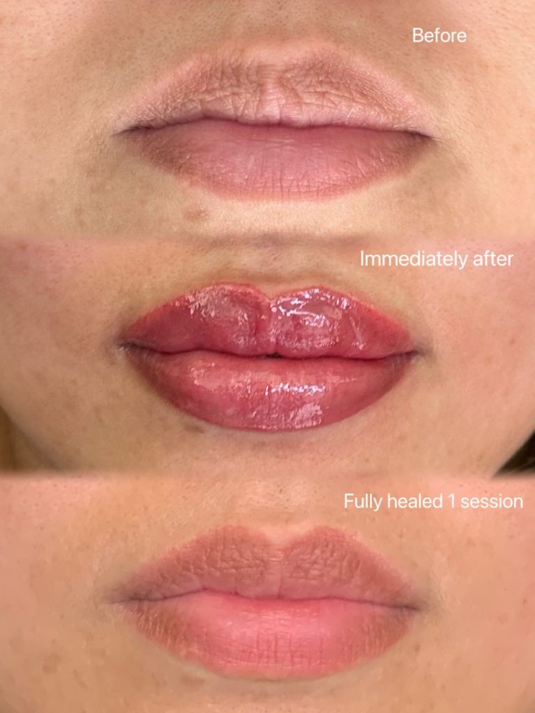 Three close-up views of lips: before treatment, immediately after with glossy pigmentation, and fully healed after one session, showing natural color and smooth texture.
