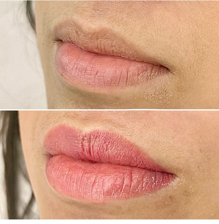 Two close-up images of lips: the top shows natural lips with a matte finish, the bottom shows the same lips looking glossier and more defined.