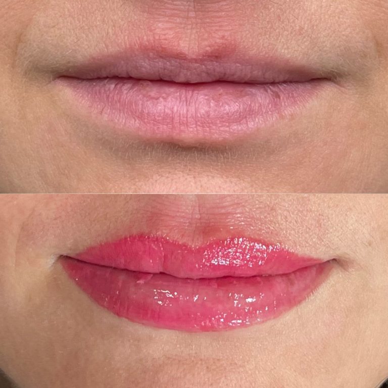 A close-up of lips in two images: the top shows natural, uncolored lips; the bottom shows the same lips with pink gloss applied.