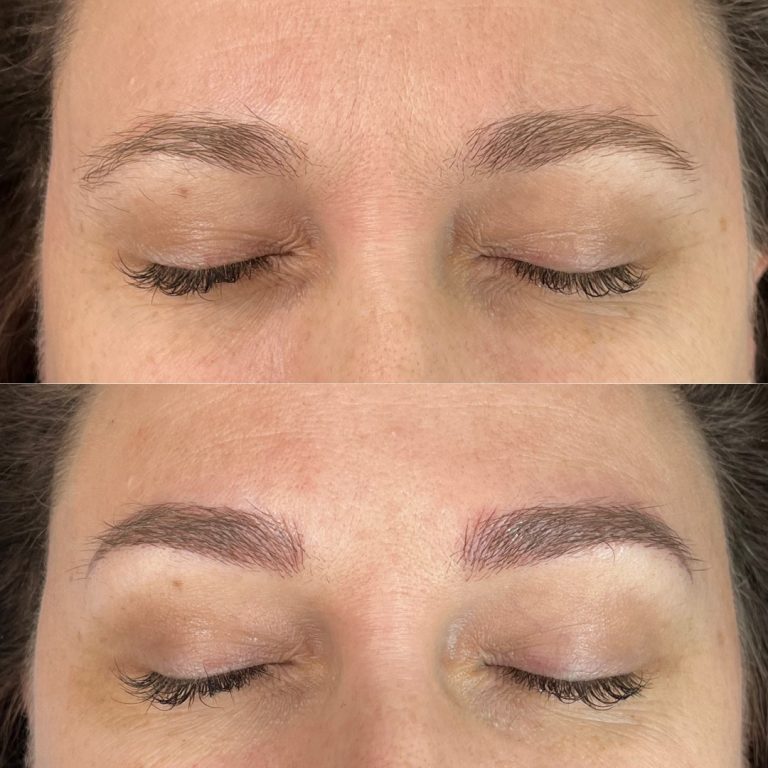 Close-up comparison of a person's eyebrows before (top) and after (bottom) enhancement, showing fuller and more defined brows in the after image.