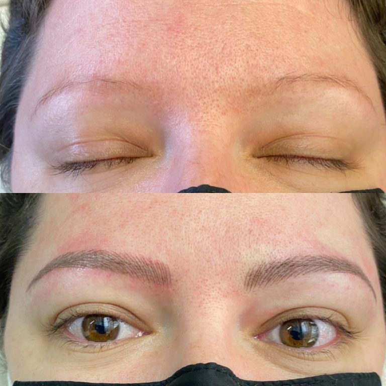 Before and after image of a person’s eyebrows, showing sparse brows before and fuller, defined brows after a cosmetic eyebrow procedure.