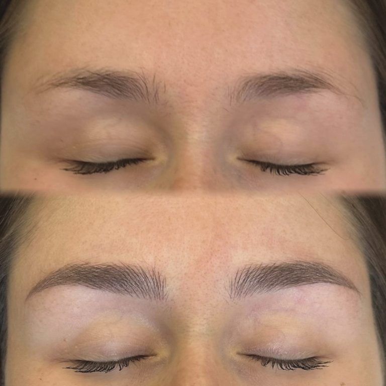 Before and after comparison of eyebrows; the top shows sparse eyebrows, while the bottom shows fuller, well-shaped eyebrows with defined arches.