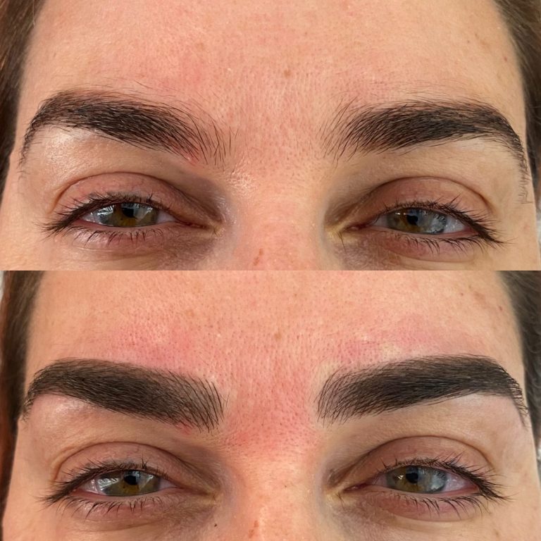 Close-up before and after images of eyebrows; top shows natural brows, bottom shows fuller, more defined brows after cosmetic enhancement.