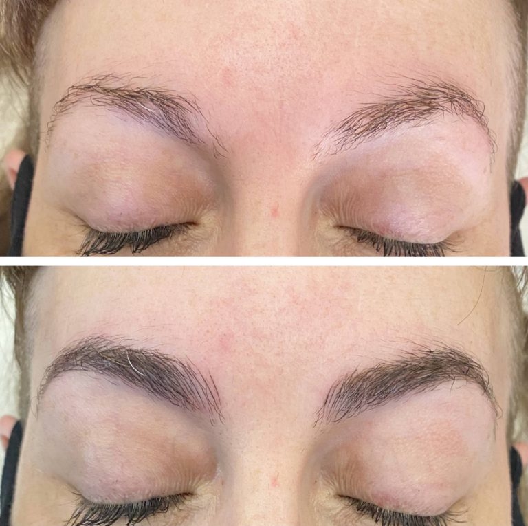 Close-up comparison of eyebrows before (top) and after (bottom) treatment, showing fuller and more defined brows in the after image.