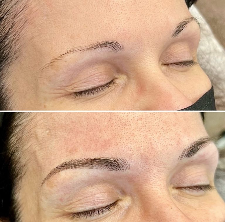Close-up before and after images of a person’s eyebrows, showing sparse brows in the first and fuller, defined brows after a cosmetic procedure in the second.