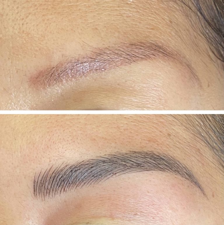Close-up comparison of an eyebrow before and after microblading; the top eyebrow is sparse, while the bottom eyebrow appears fuller and more defined.