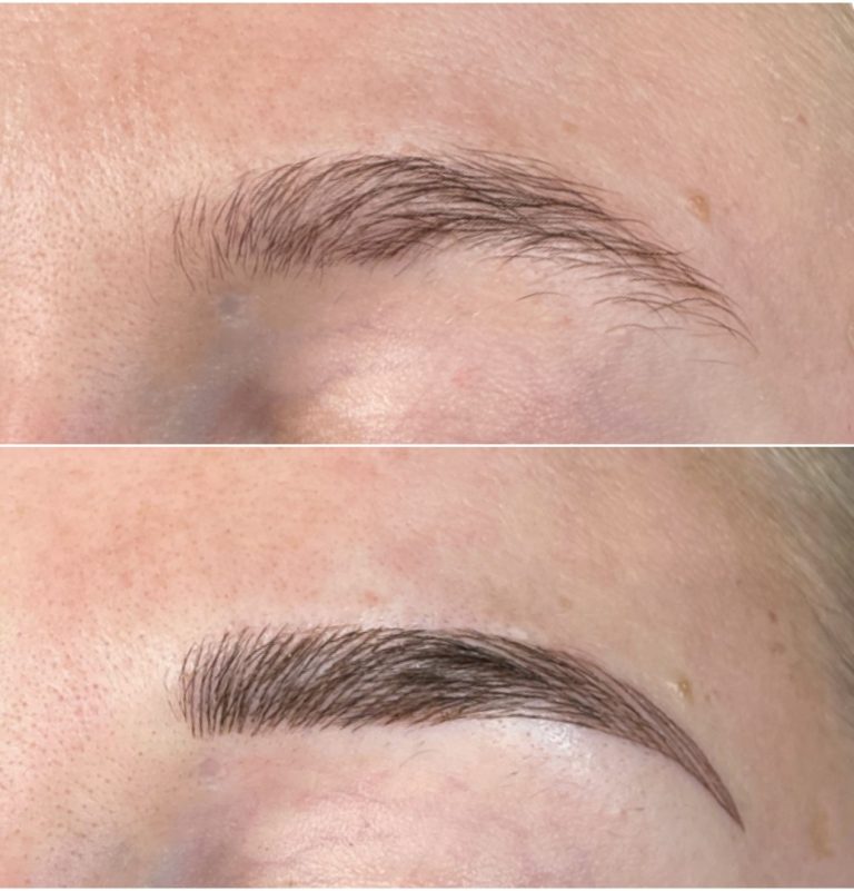 Close-up comparison of an eyebrow before (top, sparse and uneven) and after (bottom, fuller and well-defined) cosmetic enhancement.
