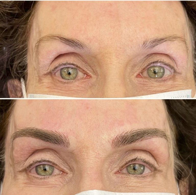 Top image shows sparse, light eyebrows; bottom image shows fuller, well-defined eyebrows after cosmetic enhancement. Both images focus on the same person's eyes and brows.