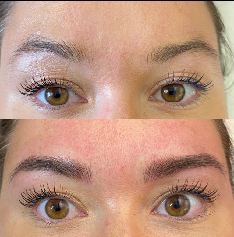 Close-up of a person's eyes and eyebrows, showing sparse eyebrows in the top image and fuller, shaped eyebrows in the bottom image.