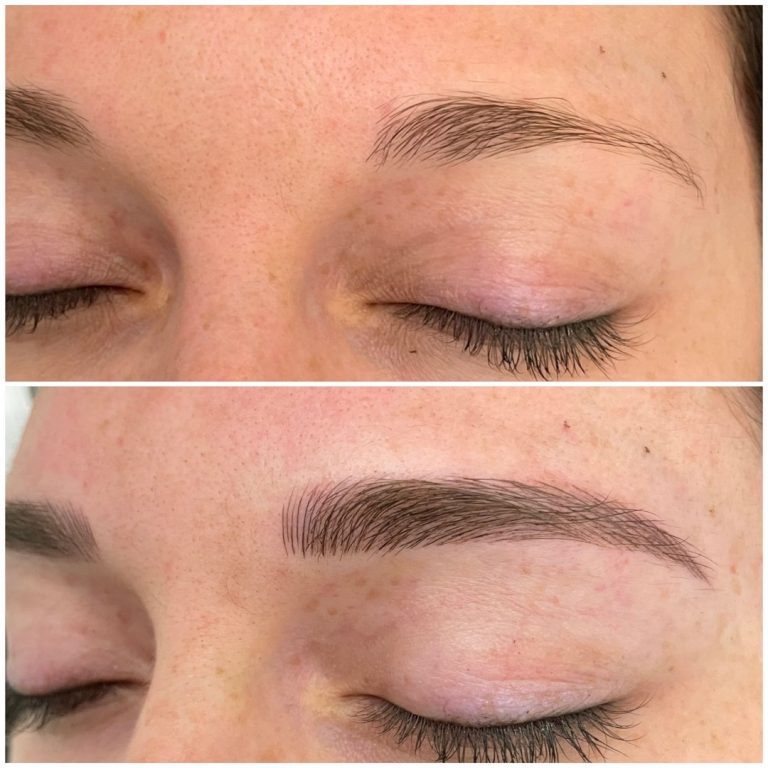 Close-up of a person's closed eye showing eyebrows before (sparse and thin) and after (fuller and defined) an eyebrow enhancement treatment.