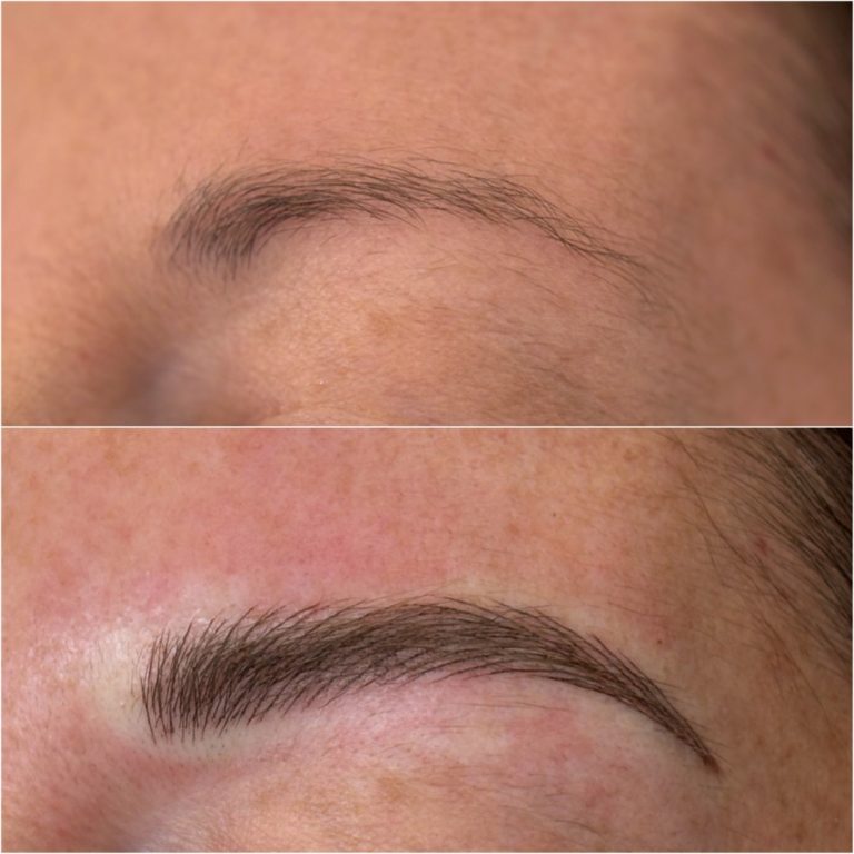 Close-up of an eyebrow before and after a cosmetic procedure, showing the eyebrow looking fuller and more defined in the after image.