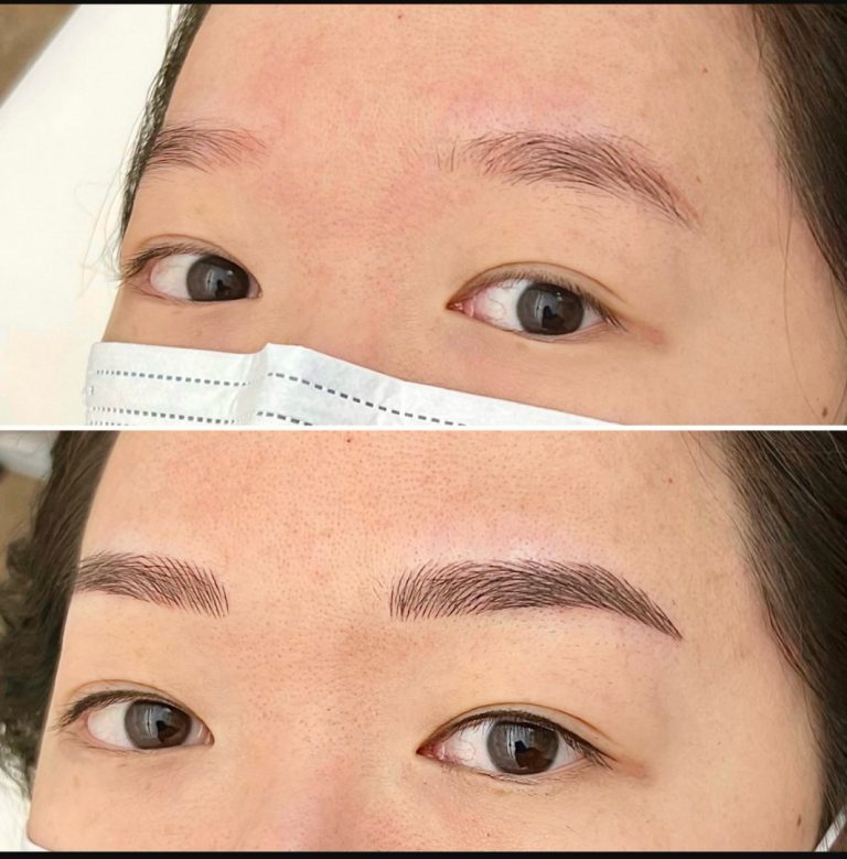 Close-up of a person's face showing eyebrows before (sparse, light) and after (full, defined) a cosmetic eyebrow procedure, with a mask covering the nose and mouth.