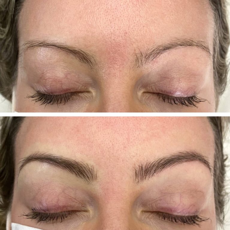 Close-up of a person’s closed eyes shows their eyebrows before (top, sparse) and after (bottom, fuller and more defined) an eyebrow enhancement treatment.